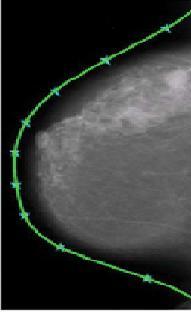 A. Input V. METHODS In recent new hospitals the screen film mammography is being replaced with digital mammography.