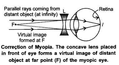 The ability of eye lens to adjust its focal length to form the sharp image of the object at varying distances on the retina is called its power of accommodation.