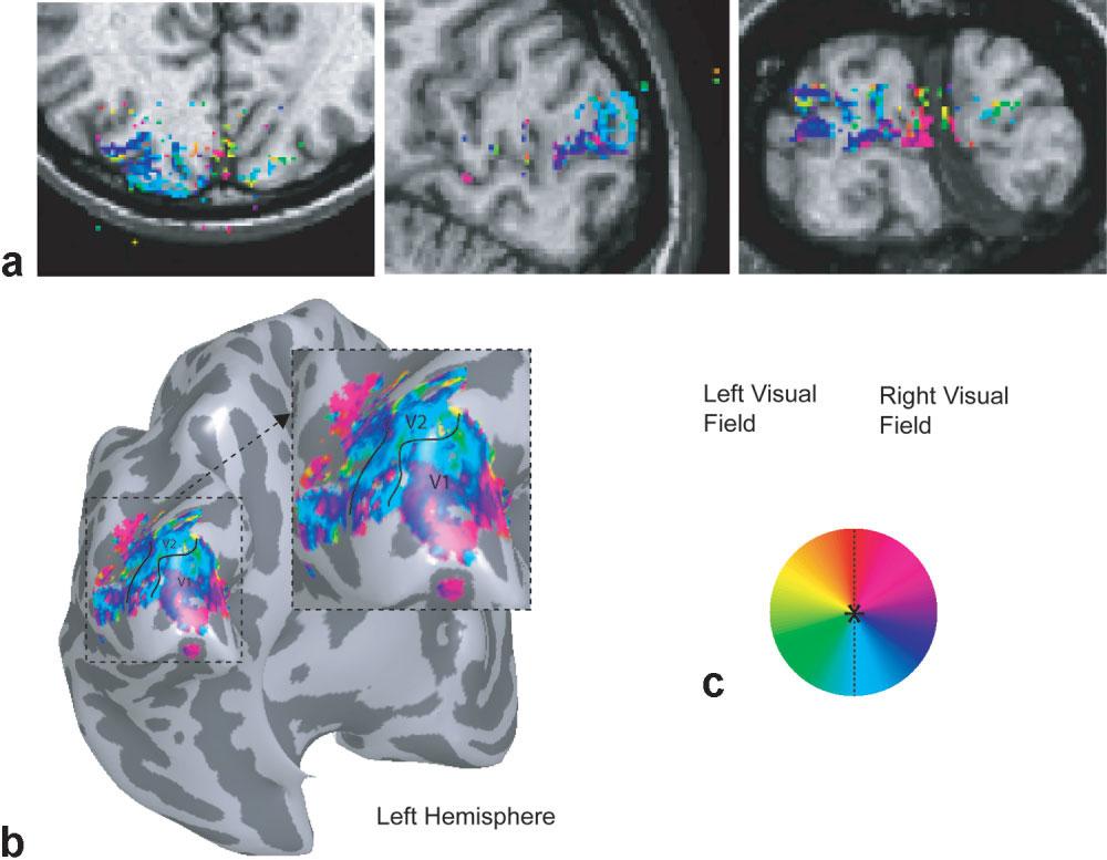1108 Lee et al. FIG. 9. Visual field mapping at isotropic 1 mm resolution. The phase of the thresholded voxels was overlaid on a T 1 anatomical image (a).
