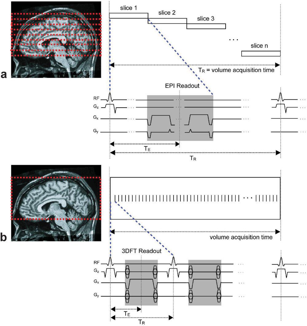 Passband b-ssfp fmri 1101 FIG. 2. Pulse sequences for GRE-BOLD and b-ssfp fmri.