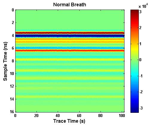 PIERS ONLINE, VOL. 6, NO. 7, 2010 697 Figure 2: is the dataset of normal breathing, in which X-axis represents different traces from No. 1 to No.