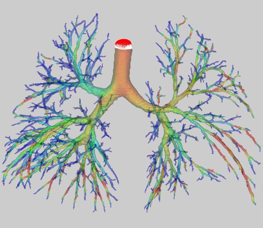 CFD in Biomedical application: Predicting breathing cycle* Two time steps in an oxygen uptake simulation of a breathing
