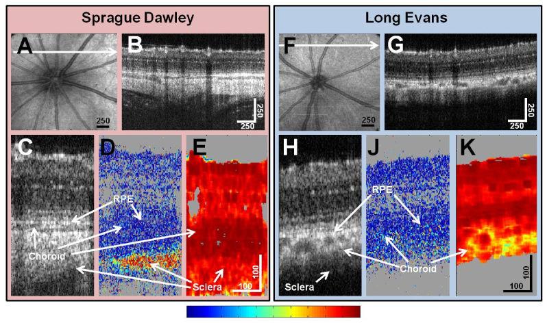 Baumann et al. Page 16 Fig. 4. Retinal PS-OCT imaging in rats. (A-E) Sprague Dawley rat. (F-K) Long Evans rat. (A, G) Fundus projection images showing the retinal vasculature around the optic disk.