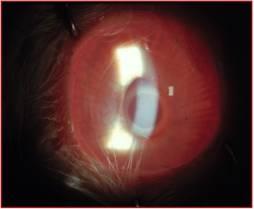 A. Corneal injury thresholds for short pulses and water absorption B. Corneal lesion 10.6 mm, 100 msec C.