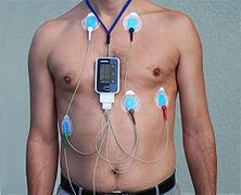 Holter monitor Not automatic