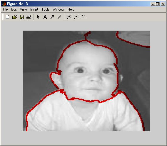 After that, the edges computation starts and the edges are created (figure 5). Finally the image with a red line over the discrete segments appears (figure 6). Fig.4. The original image of a baby Fig.