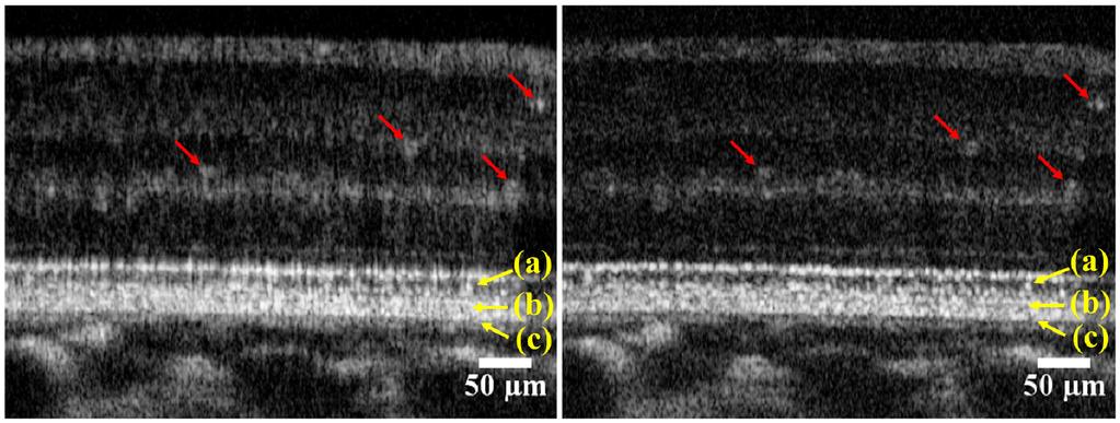 Fig. 3. Retinal images taken a 4 nasal to the fovea center from a subject (#1) in good retinal health.
