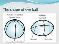 50x180 Presbyopia age related condition where the