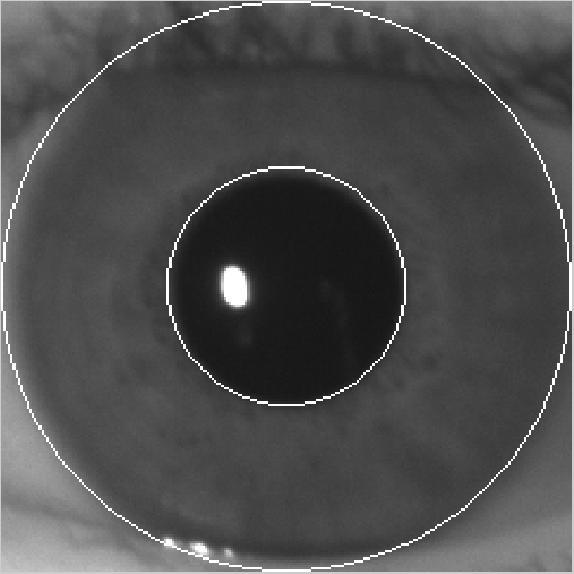 Figure 6. Iris and Pupil Segmentation 3.