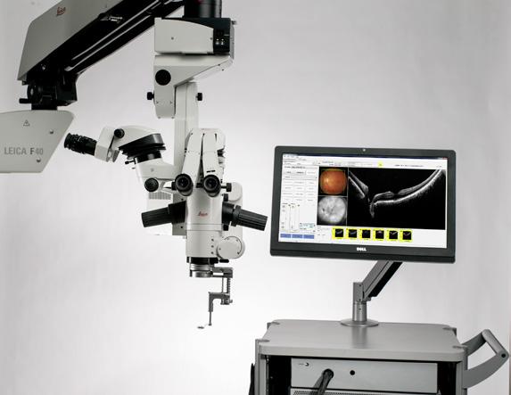 The OCT is compatible with common fundus viewing systems, which are easily attached to a dovetail mount.