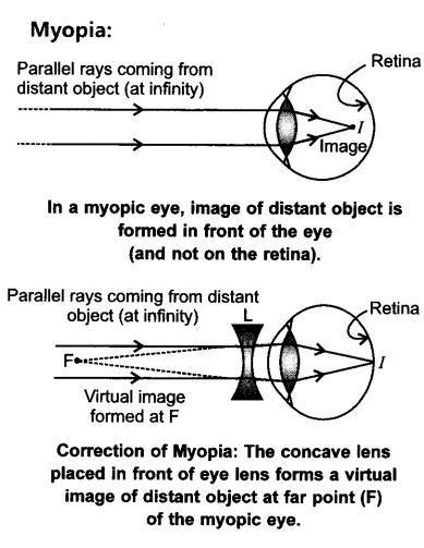 5. Retina: The light sensitive surface of eye on which image is formed. It is equivalent of the photographic film in a camera. It contains rods and cones. 6.
