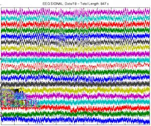 2 Figure 1: Original EEG signal presenting 19 channels with the additive noise of 50 Hz Figure 2: The EEG signal after the removal of the signal noise components General methods of signal segments