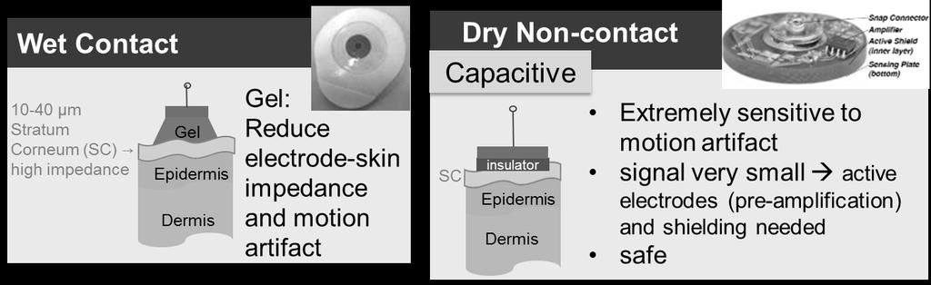 Types of Electrodes Dry Contact Non-invasive Topic