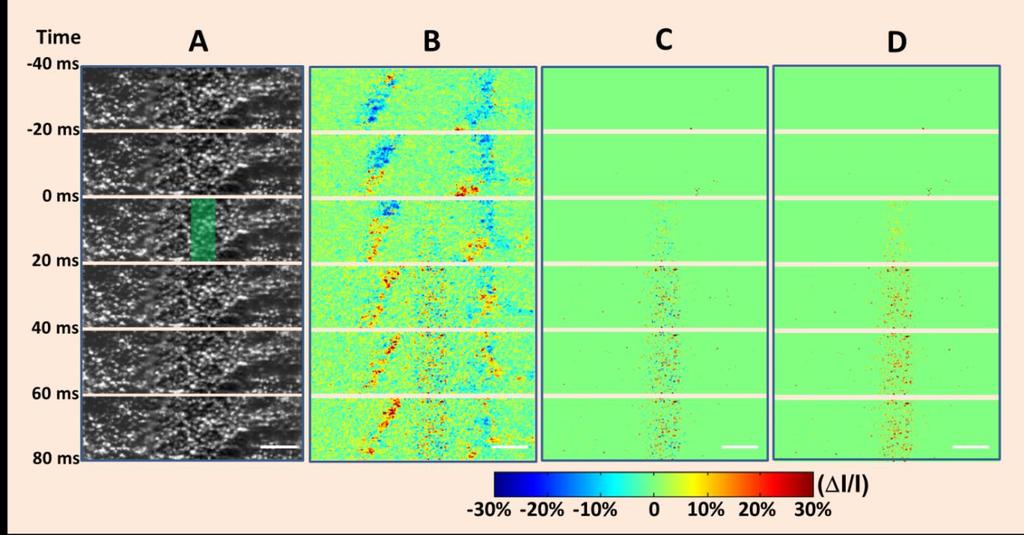 Figure 3. Confocal images of frog retina. (A) Confocal images of frog retina; each illustrated frame was the average over 20 ms. Epochs of 40 ms (pre-stimulus) and 80 ms (post-stimulus) are shown.