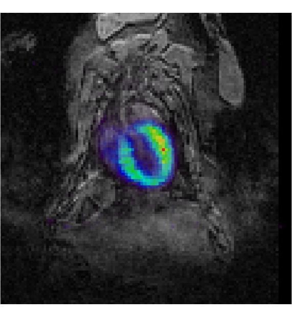 Simultaneous PET/MRI of Mouse Heart Transverse Coronal Sagittal Healthy female mouse,