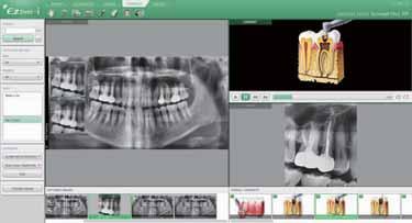 EZDENT-I: QUICK AND EASY DENTAL IMAGING SOFTWARE EzDent-i provides a wide array of functions designed to streamline the dental practice's workflow.