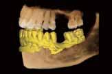 LOW DOSE AND HIGH IMAGE QUALITY What has been developed at Vatech breaks many conventions in dental radiography.