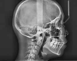 dosage and scan the ideal area of cranial anatomy for your