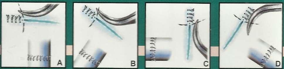 STITCHES ON A PRACTICE CARDS sutures