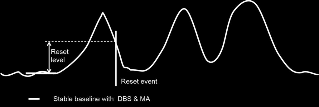 FWPD Pulse Detection DBS & MA Detection window The pulse start is determined by the trigger level, while the pulse end is determined by the reset level.