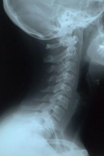 G) X-Rays -Shorter wavelength and higher frequency than UV rays 1) X-rays are used in medicine, industry, and
