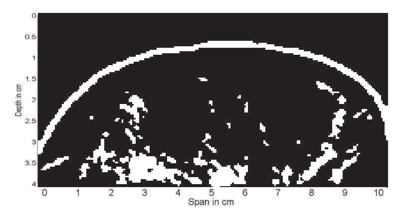 distribution in the MRI scan to the FDTD grid.
