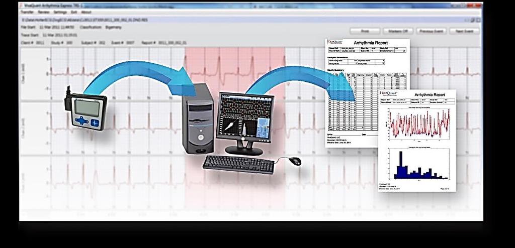 Wearables that detect cardiac arrhythmias The fixed-point test platform we built with MATLAB enabled us to conduct rigorous tests at every stage and automatically