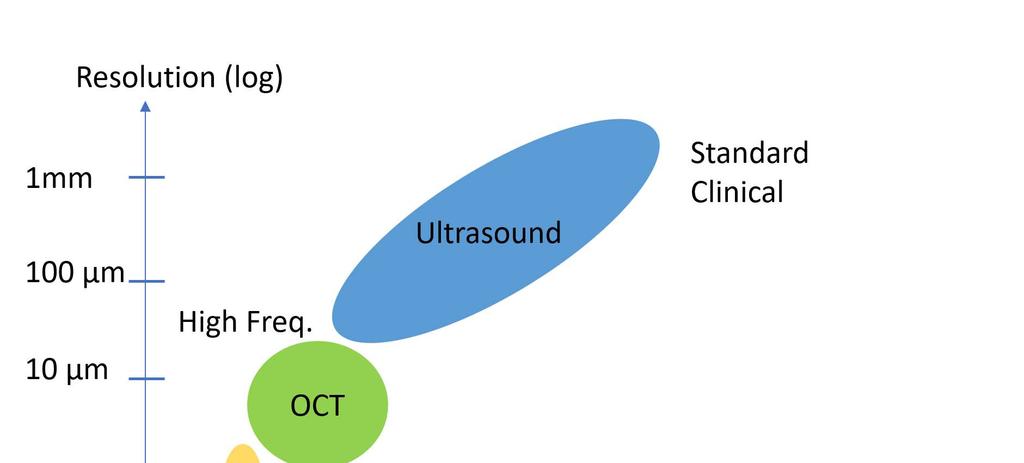Figure 1 In the graph we can see the role that OCT takes, which fills up the gap between Ultrasound method and Confocal Microscopy. 1.2 Principles OCT is a system based on interferometry.