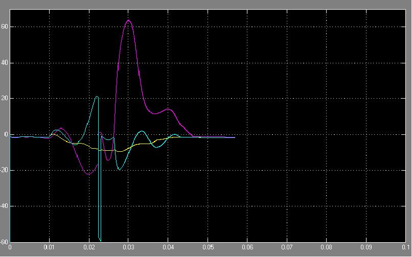 The output waveform of without UPFC was drawn between power angles and delay time.by using UPFC in the power line the oscillations to be minimized at the time of 0.045 sec.