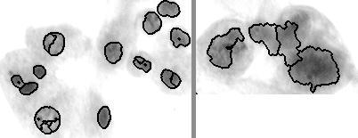 [4/4] Extraction of the nuclei s boundaries Do not work well on heterogenous cells.