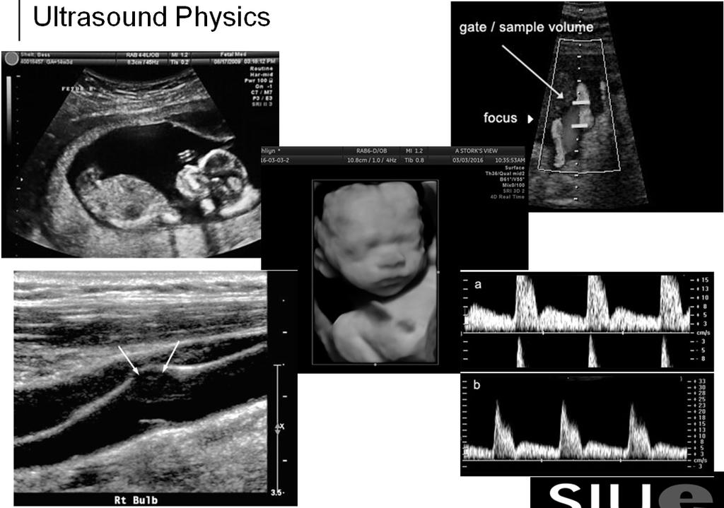 Ultrasound Physics History: Ultrasound