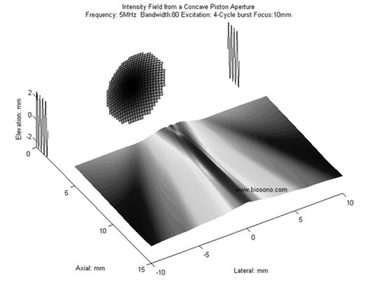 Ultrasound Physics: Beam Patterns and Focusing