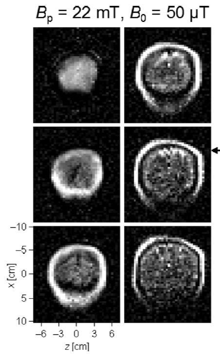 MRI: Detecting Larmor preseccion Ultra-low-field magnetic