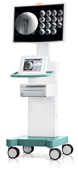 All functions required for image capturing, processing and archiving are integrated into the C-arm. Its compact design and easy-drive system make the ideal for even the smallest ORs.