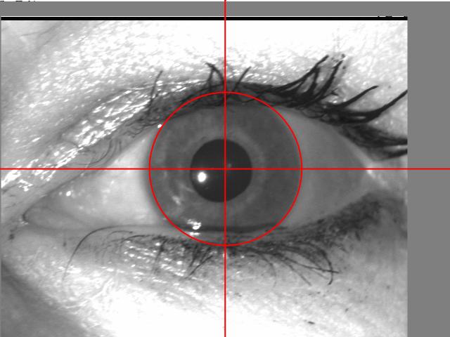Section 4 provides an example use case - the detection of defective pixels in the images of the ND- Iris-Template-Aging-2008-2010 DB [1] which required image alignment in advance.