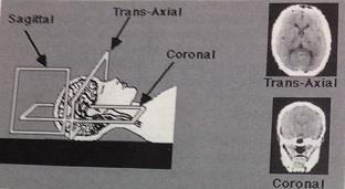 The trans-axial (human) or transverse (dog) plane is perpendicular to the plane of the CT table and transects the subject into superior/cranial and inferior/caudal portions.