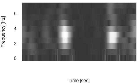 accelerometer. Fig. 4 (b) represents the data calculated by STFT. Here X-axis represents time and Y-axis represents frequency. Light and shade represent the intensity of the amplitude spectrum.