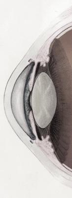 Non-invasive imaging of tear film is important in understanding dry eye