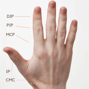 in [9] Finger Name Tip-DIP (cm) DIP-PIP (cm) PIP-MCP (cm) Index Finger (I) 2.23 1.3 x I =2.