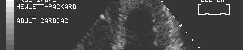 The Ultrasound Image In