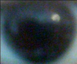 directly have the images of the germ. (h; photo of the eye, h1:h2, h3, h4, h5, h6)