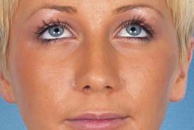 close-up Face Target area: 15x10cm (horizontal) Reproduction Ratio: 1:4 Patient