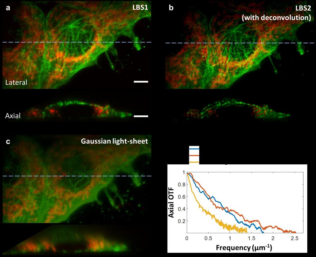 Supplementary Figure 3 Comparing the axial resolution of LBS1, LBS2 and Gaussian lightsheet with fixed HT22 cells double stained with Alexa488 anti-tubulin (Green) and Alexa560 anti-tom20