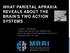 WHAT PARIETAL APRAXIA REVEALS ABOUT THE BRAIN'S TWO ACTION SYSTEMS