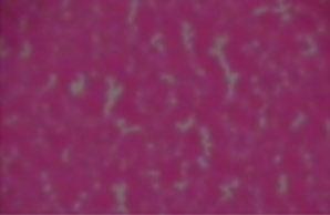 The result of flat top dot plates with proper microcell structures is a gravure-like ink laydown.