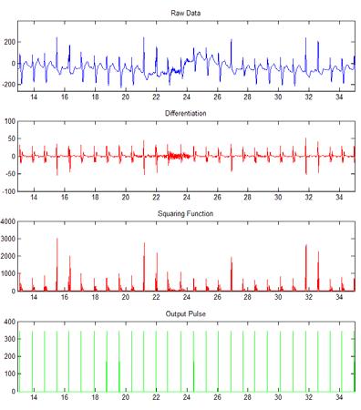 Figure 3.12 Beat detection of ECG signals with different types of distortion 3.4.2 Spectral Analysis of HRV 3.4.2.1 Artificial RR Interval Data To compare spectral analysis performance of different algorithms, an understanding of the underlining oscillations within the signal is required.