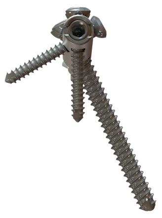 5 mm Syndesmosis screws 130mm & 180mm 40mm 30mm 40, 45, 50, 55, 60, 65, 70mm 19mm 14mm 10mm 6mm Syndesmosis Screws Catalog # Label Description CO3540-D 3.