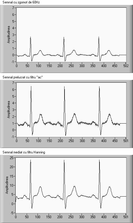 Proceedings of the 7th WSEAS Int. Conf. on Signal Processing, Computational Geometry & Artificial Vision, Athens, Greece, August 24-26, 2007 10 Fig.6. Electrocardiogram and low-pass electrocardiogram.