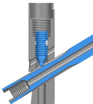 As noted above, the LAG SCREW INSERTER must be positioned so that the handle on the inserter is parallel or perpendicular to the colored dots on the TARGETING GUIDE in order for the SET SCREW and LAG