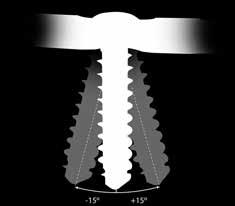 When the screw is fully seated during final tightening, an increase of resistance indicates sufficient screw fixation.